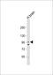 Cyclin And CBS Domain Divalent Metal Cation Transport Mediator 2 antibody, 57-536, ProSci, Western Blot image 