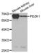 PDZ Domain Containing 1 antibody, abx004068, Abbexa, Western Blot image 