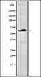 A-Raf Proto-Oncogene, Serine/Threonine Kinase antibody, orb337434, Biorbyt, Western Blot image 