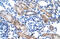 Chloride Intracellular Channel 1 antibody, ARP35045_T100, Aviva Systems Biology, Immunohistochemistry paraffin image 