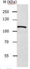 ADAM Metallopeptidase With Thrombospondin Type 1 Motif 5 antibody, orb107472, Biorbyt, Western Blot image 