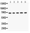 Menin 1 antibody, LS-C357426, Lifespan Biosciences, Western Blot image 