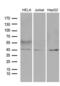 U7 snRNA-associated Sm-like protein LSm11 antibody, LS-C792325, Lifespan Biosciences, Western Blot image 