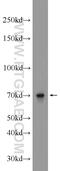ALX Homeobox 3 antibody, 22358-1-AP, Proteintech Group, Western Blot image 