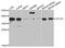 Eukaryotic translation initiation factor 2 subunit 1 antibody, STJ23509, St John