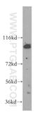 Kinesin-like protein KIF20A antibody, 15911-1-AP, Proteintech Group, Western Blot image 
