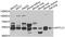 Serine Palmitoyltransferase Long Chain Base Subunit 1 antibody, orb247606, Biorbyt, Western Blot image 
