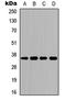 Atypical Chemokine Receptor 1 (Duffy Blood Group) antibody, LS-C354318, Lifespan Biosciences, Western Blot image 