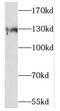 Solute Carrier Family 13 Member 4 antibody, FNab07909, FineTest, Western Blot image 
