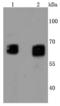 GBA antibody, A01162-1, Boster Biological Technology, Western Blot image 