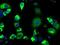 Lysyl Oxidase antibody, GTX84188, GeneTex, Immunofluorescence image 