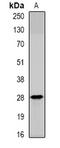 Serine Peptidase Inhibitor, Kunitz Type 2 antibody, orb382056, Biorbyt, Western Blot image 