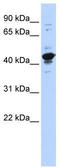RBMX Like 2 antibody, TA343813, Origene, Western Blot image 