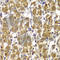 Protein Tyrosine Kinase 2 antibody, A2114, ABclonal Technology, Immunohistochemistry paraffin image 