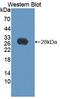 Bisphosphoglycerate Mutase antibody, LS-C663406, Lifespan Biosciences, Western Blot image 