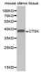 Cathepsin K antibody, PA5-76033, Invitrogen Antibodies, Western Blot image 