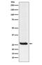Hippocalcin antibody, M03907, Boster Biological Technology, Western Blot image 