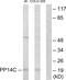 Protein Phosphatase 1 Regulatory Inhibitor Subunit 14C antibody, GTX87104, GeneTex, Western Blot image 