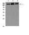 Nuclear factor of activated T-cells 5 antibody, STJ98961, St John