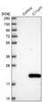Chromosome 11 Open Reading Frame 1 antibody, NBP1-82071, Novus Biologicals, Western Blot image 