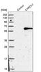 Chordin Like 1 antibody, PA5-51362, Invitrogen Antibodies, Western Blot image 