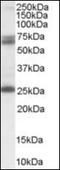 Glutamate Decarboxylase 2 antibody, orb89295, Biorbyt, Western Blot image 