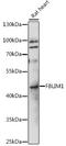 Filamin Binding LIM Protein 1 antibody, A08050, Boster Biological Technology, Western Blot image 