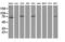 Catenin Beta 1 antibody, LS-C172638, Lifespan Biosciences, Western Blot image 