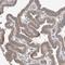 Chromosome 8 Open Reading Frame 37 antibody, NBP1-93892, Novus Biologicals, Immunohistochemistry frozen image 