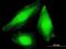 COP9 Signalosome Subunit 7B antibody, H00064708-B01P, Novus Biologicals, Immunocytochemistry image 