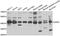 Deoxyhypusine synthase antibody, STJ28450, St John