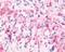 Metabotropic glutamate receptor 6 antibody, NLS4655, Novus Biologicals, Immunohistochemistry frozen image 