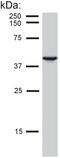 Keratin 19 antibody, GTX27755, GeneTex, Western Blot image 