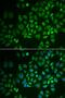 Glycosylphosphatidylinositol Specific Phospholipase D1 antibody, OAAN01903, Aviva Systems Biology, Immunofluorescence image 