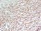 Premelanosome Protein antibody, LS-C744555, Lifespan Biosciences, Immunohistochemistry paraffin image 
