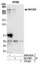 Myosin VB antibody, A305-421A, Bethyl Labs, Immunoprecipitation image 