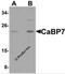 Calcium-binding protein 7 antibody, 5859, ProSci Inc, Western Blot image 