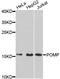 Proteasome maturation protein antibody, A9067, ABclonal Technology, Western Blot image 