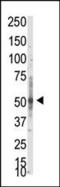 Protein arginine N-methyltransferase 3 antibody, PA5-11116, Invitrogen Antibodies, Western Blot image 