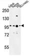 CTIP1 antibody, AP50355PU-N, Origene, Western Blot image 