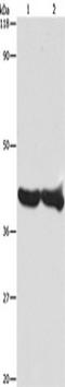 GAPDH antibody, TA349207, Origene, Western Blot image 