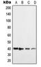 Histamine H2 receptor antibody, MBS820672, MyBioSource, Western Blot image 