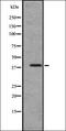 C-C Motif Chemokine Receptor 2 antibody, orb335521, Biorbyt, Western Blot image 