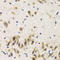 UDP-N-Acetylglucosamine Pyrophosphorylase 1 antibody, LS-C331908, Lifespan Biosciences, Immunohistochemistry paraffin image 