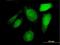 Maestro Heat Like Repeat Family Member 8 antibody, H00140699-B01P, Novus Biologicals, Immunocytochemistry image 