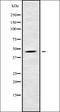 Cytochrome B5 Reductase 4 antibody, orb337821, Biorbyt, Western Blot image 