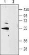 5-hydroxytryptamine receptor 1B antibody, TA328698, Origene, Western Blot image 
