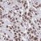 Spectrin Repeat Containing Nuclear Envelope Family Member 4 antibody, HPA060253, Atlas Antibodies, Immunohistochemistry frozen image 