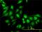 Serine/threonine-protein kinase MST4 antibody, H00051765-M02, Novus Biologicals, Immunofluorescence image 