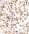 Heterogeneous Nuclear Ribonucleoprotein A1 Like 2 antibody, M16841, Boster Biological Technology, Immunohistochemistry paraffin image 